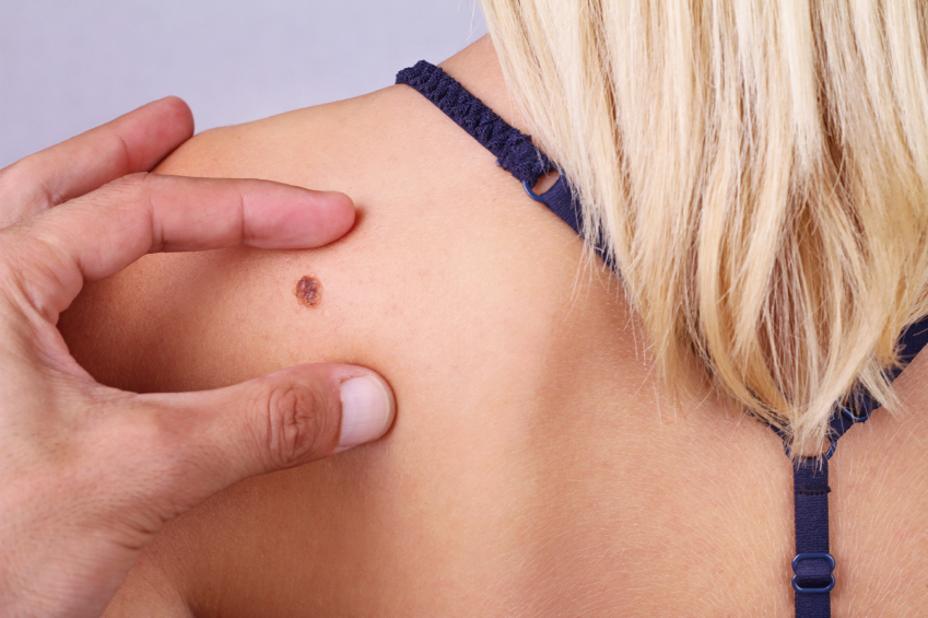 Skin Exam